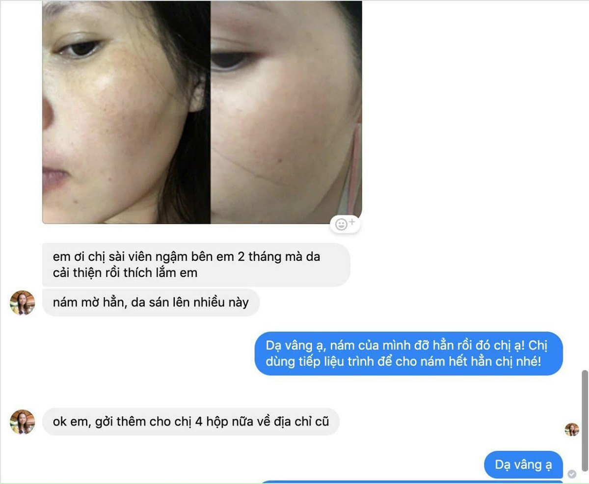 Review Viên ngậm trắng da Glutathione 100mg của Ý