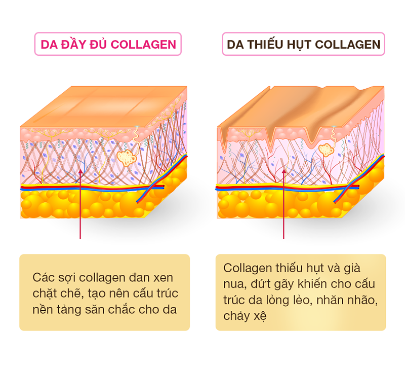 Lợi ích của Collagen
