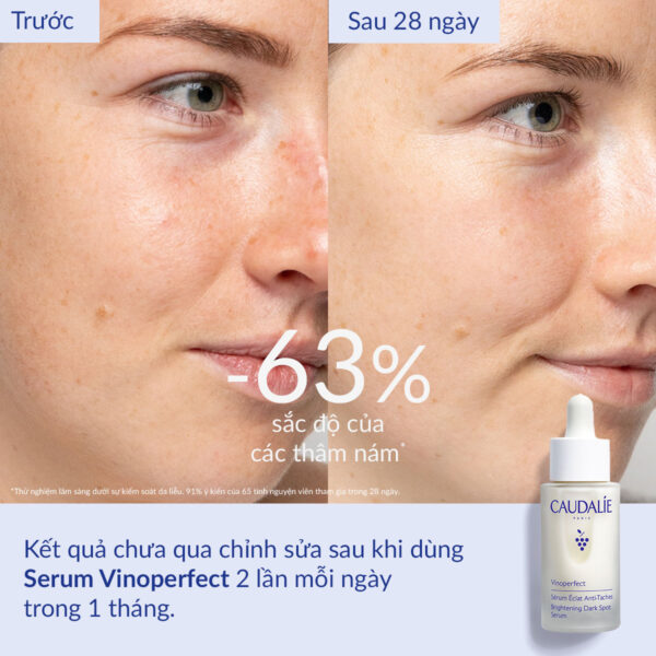 Serum Caudalie Vinoperfect Pháp 10ml - Tinh chất trị nám, trắng da, mờ vết thâm | EU Store