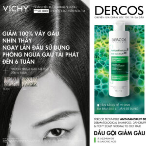 Dầu gội trị gàu Vichy Dercos Anti Dandruff xanh 200ml sạch gàu, giảm ngứa, làm dịu da dầu | eustore.com.vn