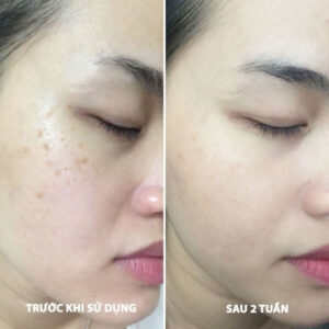 Bút chấm trị nám, tàn nhang Eucerin Spotless Brightening Spot Corrector 5ml có tốt không? | eustore.com.vn