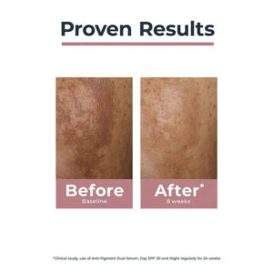 Serum nám Eucerin Spotless Brightening Booster 30ml – Trị thâm nám, tàn nhang, làm sáng da đều màu | eustore.com.vn