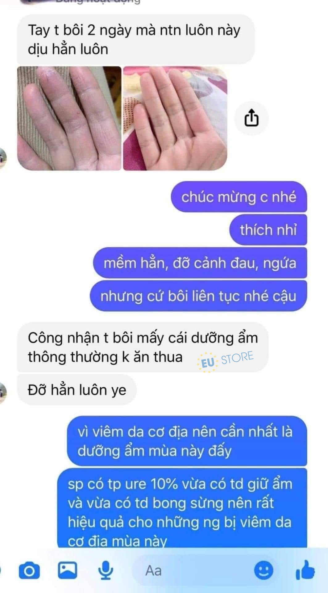 Review Kem dưỡng da tay Ziaja Med Ure 10% giảm khô nứt, kích ứng & làm mềm da tay Review Kem dưỡng da tay Ziaja Med Ure 10% giảm khô nứt, kích ứng & làm mềm da tay