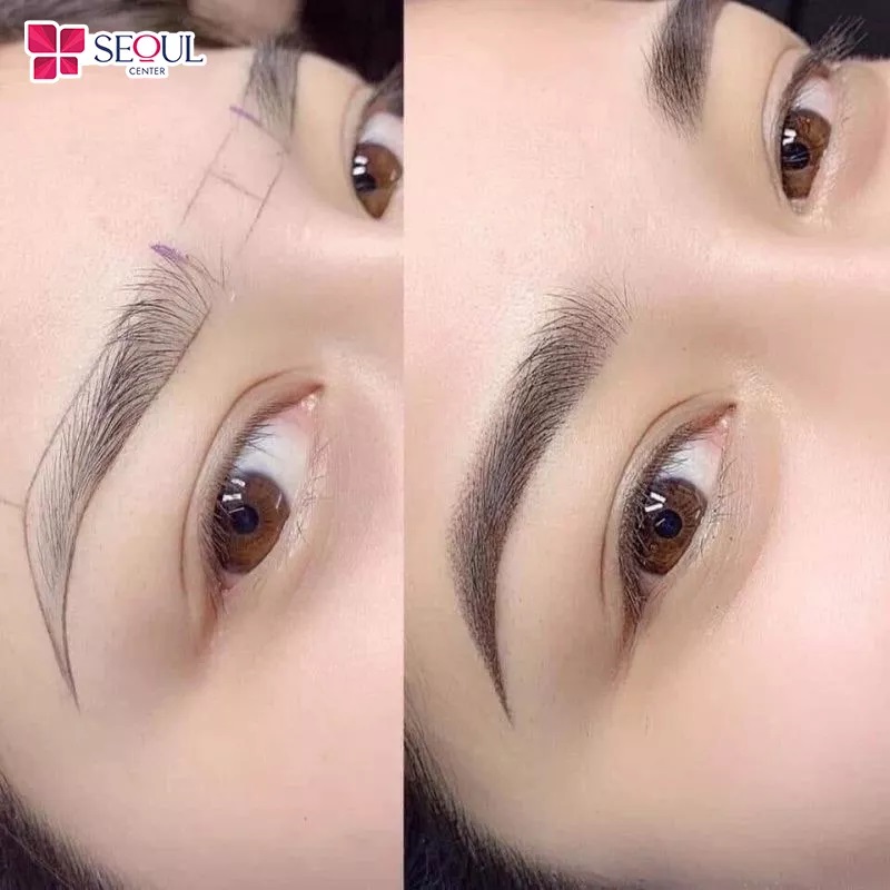 Thẩm mỹ viện Seoul Center là địa chỉ phun mày ombre uy tín, chất lượng, an toàn 
