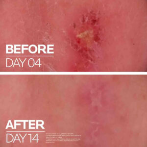 Kem làm dịu & Phục hồi da La Roche-Posay Cicaplast Baume B5+
