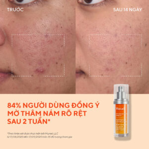 Tinh chất mờ nám, đốm nâu Murad Rapid Dark Spot Correcting Serum 30ml