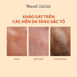 Tinh chất mờ nám, đốm nâu Murad Rapid Dark Spot Correcting Serum 30ml