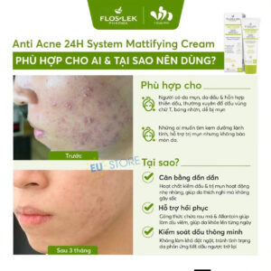 Kem dưỡng kiềm dầu, hỗ trợ giảm mụn Floslek ANTI ACNE 24h System 50ml